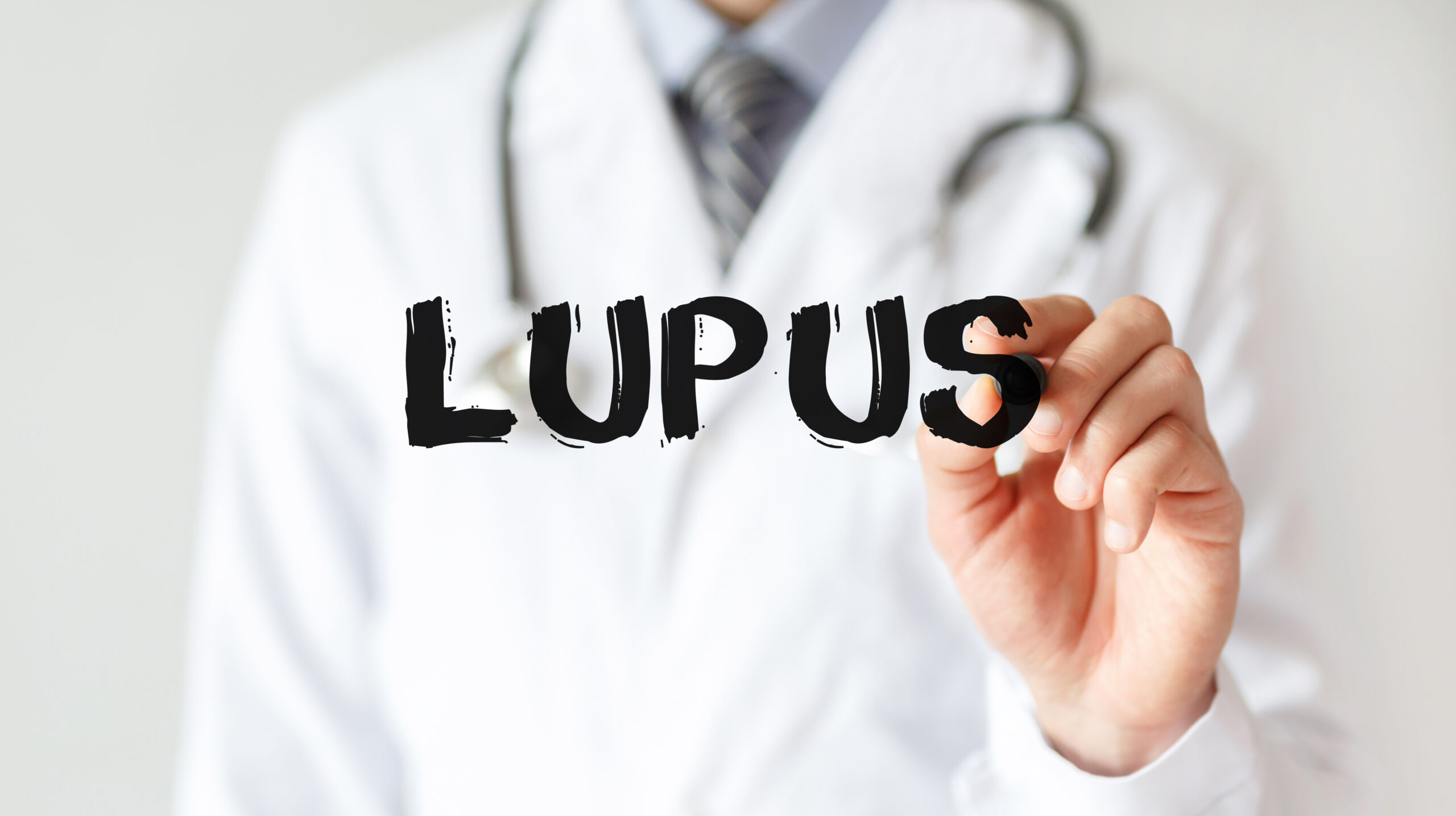 Here’s What Lupus Feels Like, Say Physicians