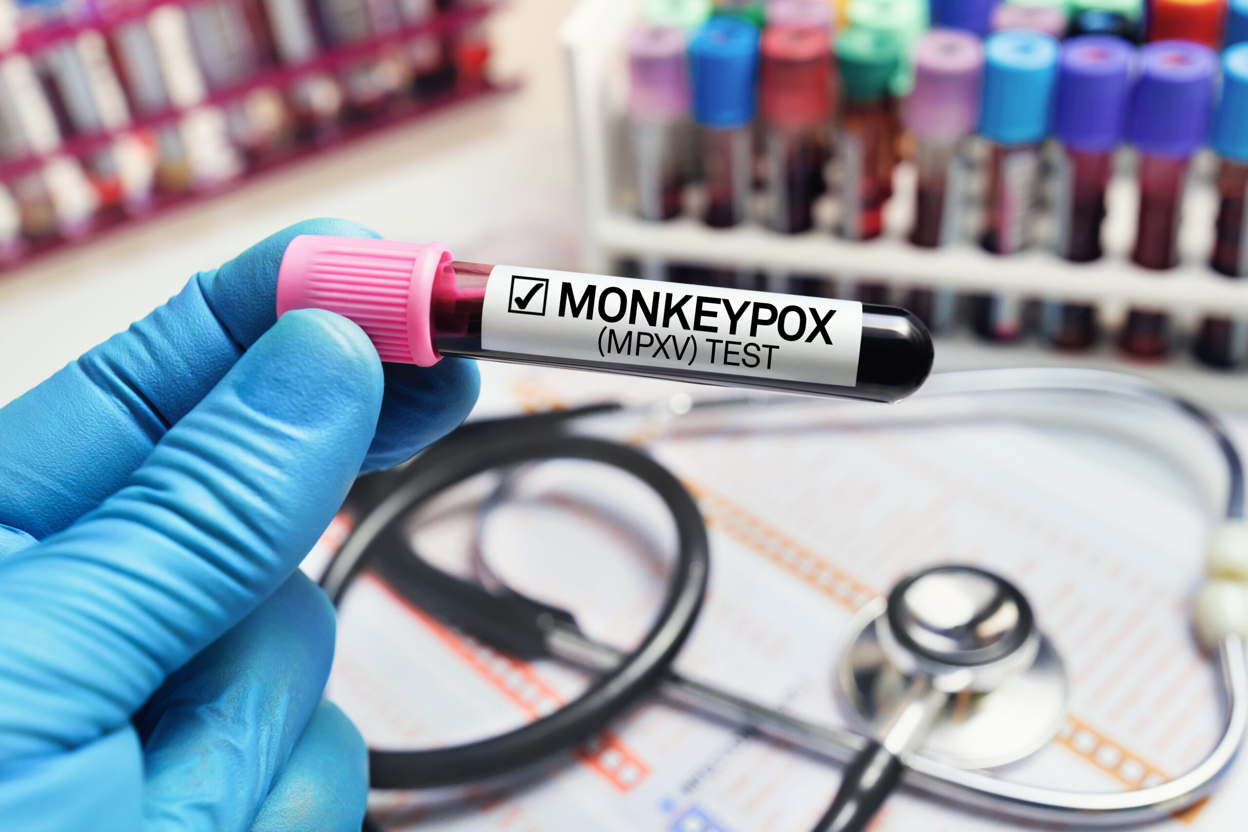 monkeypox, Dr. Curry-Winchell