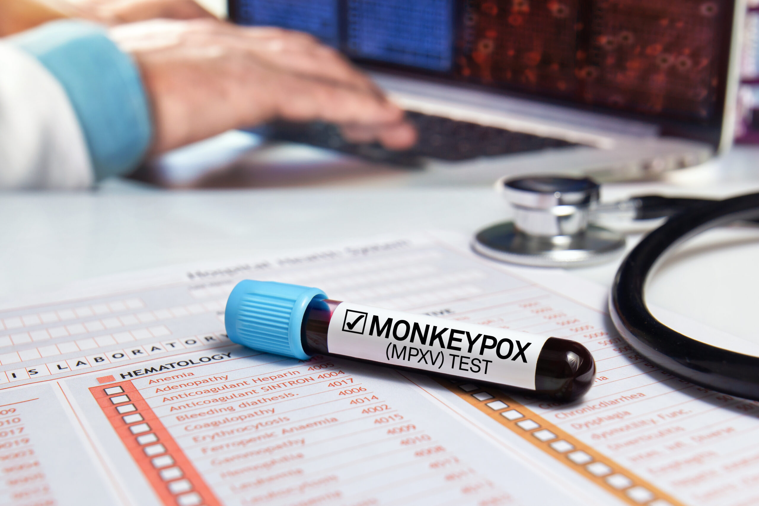 Health district announces Monkeypox vaccine appointments